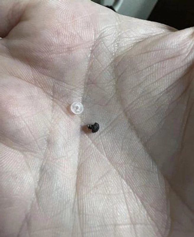 Zip Tag Kit: No More Skin Tags