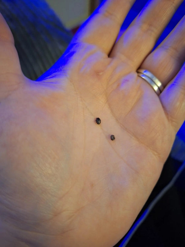 Zip Tag Kit: No More Skin Tags