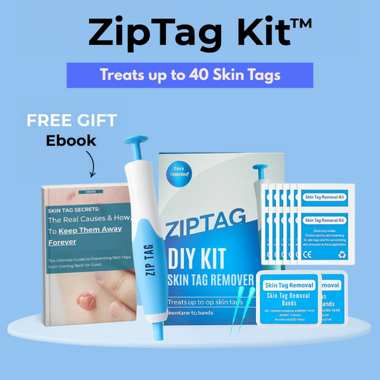 Zip Tag Kit: No More Skin Tags
